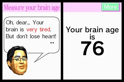 Brain Age